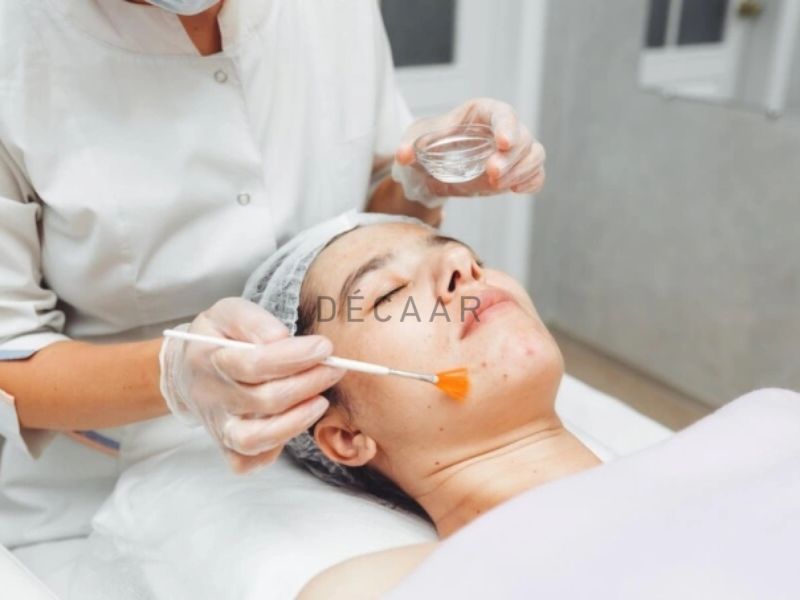 Peel tại spa.